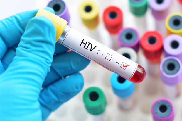 Oxford scientists begin trial on novel HIV vaccine