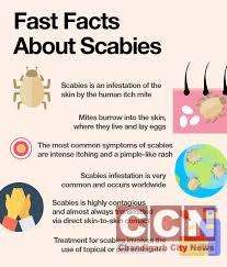 How Is Scabies Treated?